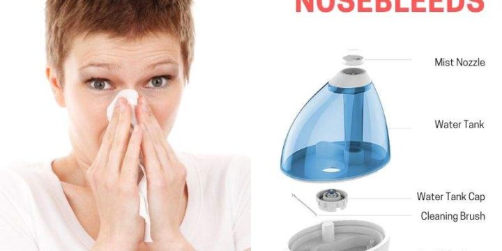 Best Humidifiers For Nosebleeds (Reviews and Buying Guide 2024)